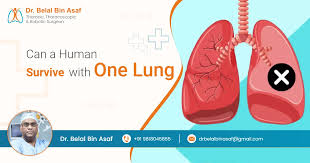 Can you live with one lung